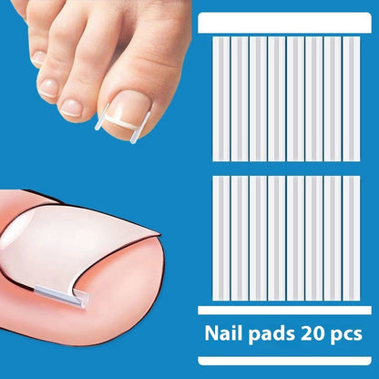 Groove Nail Braces Ingrowth Isolation Filling Gasket